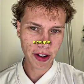 traded his hairline for couple mil @brezscales #brezscales #brez #hairline 