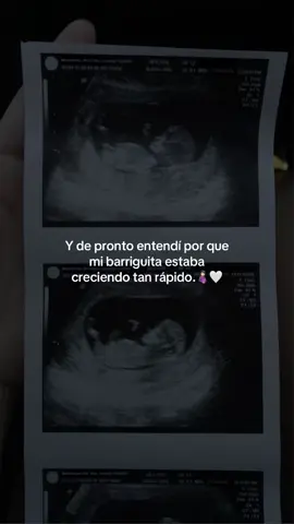 🤰🏻🤍🫣#fypシ゚ 