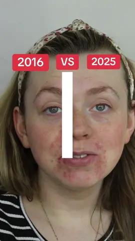 forgive the editing skills. I’m trying to edit this while I feed a baby haha. Saw @Eloise 🦋 and wanted to do my own take. #eyebrowtutorial #eyebrows #2016makeup #makeuptok #makeuphacks 