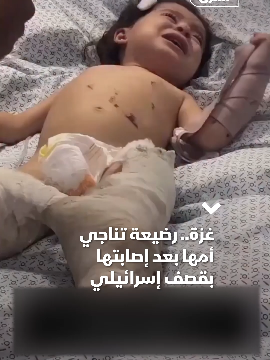 فيديو متداول لطفلة رضيعة من غزة تعرضت لإصابات بالغة جراء القصف الإسرائيلي