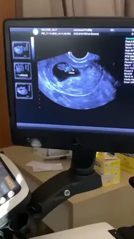 Toi femme qui n’arrive pas à tomber enceinte tu es ménopausée tu as les kystes fibromes myomes trompes bouchées etc … Tu tomberas enceinte et tu accoucheras #grossesse2026 #twins2026 #tomberenceinte #fertility2026 #jumeaux 