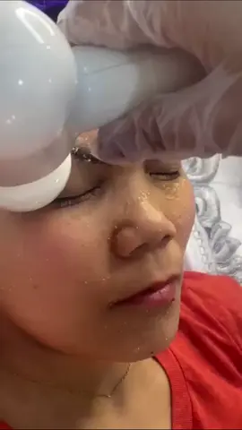 Facial and BB Glow Facial Treatment Kurtis at Kinis Ganda😍  🧡BENEFITS for BB GLOW FACIAL🧡 Benefits of BB Glow Treatment Makes your skin-tone even. Reduces freckles. Fights pigmentation. Accelerates the growth of collagen to stimulate the anti-ageing system of your skin. Reduces pimples, blemishes and acne scars. Improves elasticity and skin firmness. Reduces fine lines and wrinkles. #kuwait #kuwait🇰🇼 #kuwait_tiktokers_philipines🇵🇭🇰🇼 #kuwait_tiktoker 