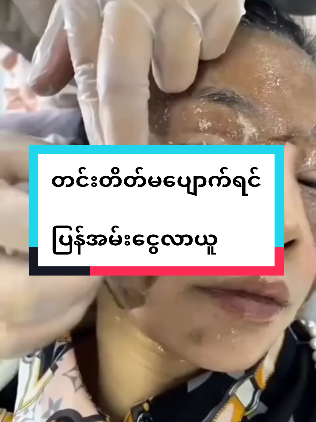 Replying to @k.zin.phyo85 #တင်းတိတ်လုံး၀မသိသာရင်ငွေပြန်အမ်းမယ် #HCထောပတ်သီးအမာရွတ်တင်းတိတ်ပျောက်ဆေးမှုန့် #မြင်ပါများပီးချစ်ကျွမ်းဝင်အောင်လို့🤒🖤 #၀၉၉၅၅၇၂၄၆၂၃ကိုလည်းဆက်သွယ်မှာယူလို့ရပါတယ် 