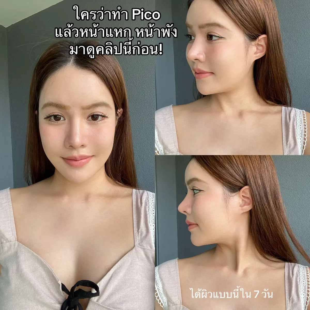 ใครกำลังสนใจทำ Pico มามุงทางนี้ก่อนจ้า! @Aura Bangkok Clinic  #AuraBangkokClinicxMizumi #CompleteYourSkinCycle #Picoออร่าxกันแดดฟ้ามิซึมิ   