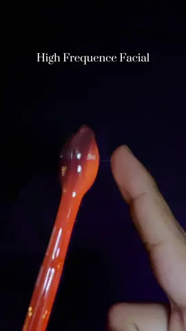 Bước này đa số khách nào nghe tiếng cũng sợ, nhưng hãy xem công dụng tuyệt vời của nó nào 😗  #samsambeauty#chamsocda #xh #nanmunchuanykhoa #spa 