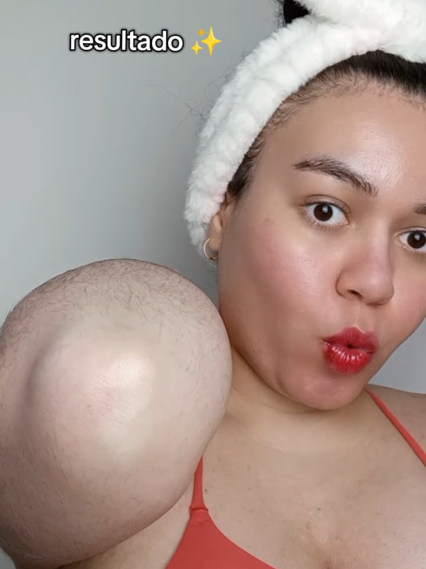cotovelos escuros é coisa do passado! 🔥 produto utilizado no vídeo >>  RETINOL 0.2 BOOSTING SHOT AMPOULE @SKIN1004 US @skin1004.brasil #retinol #skin1004 #centella #koreanskincare #skincareroutine 			