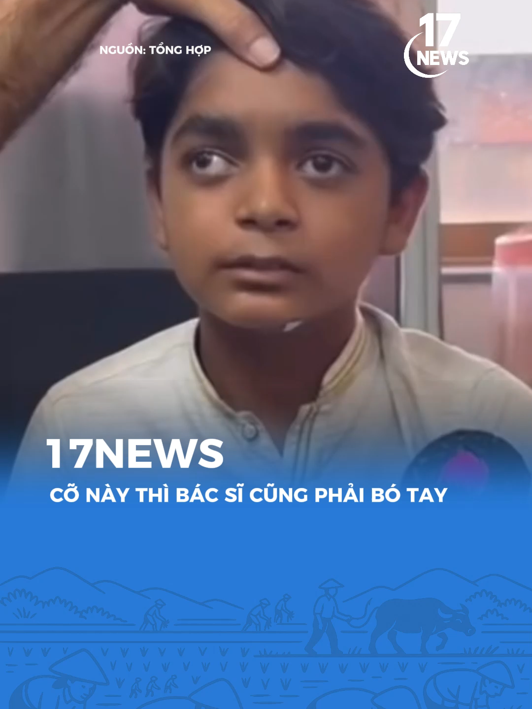 Bác sĩ tầm này cũng bó tay #17news #17network