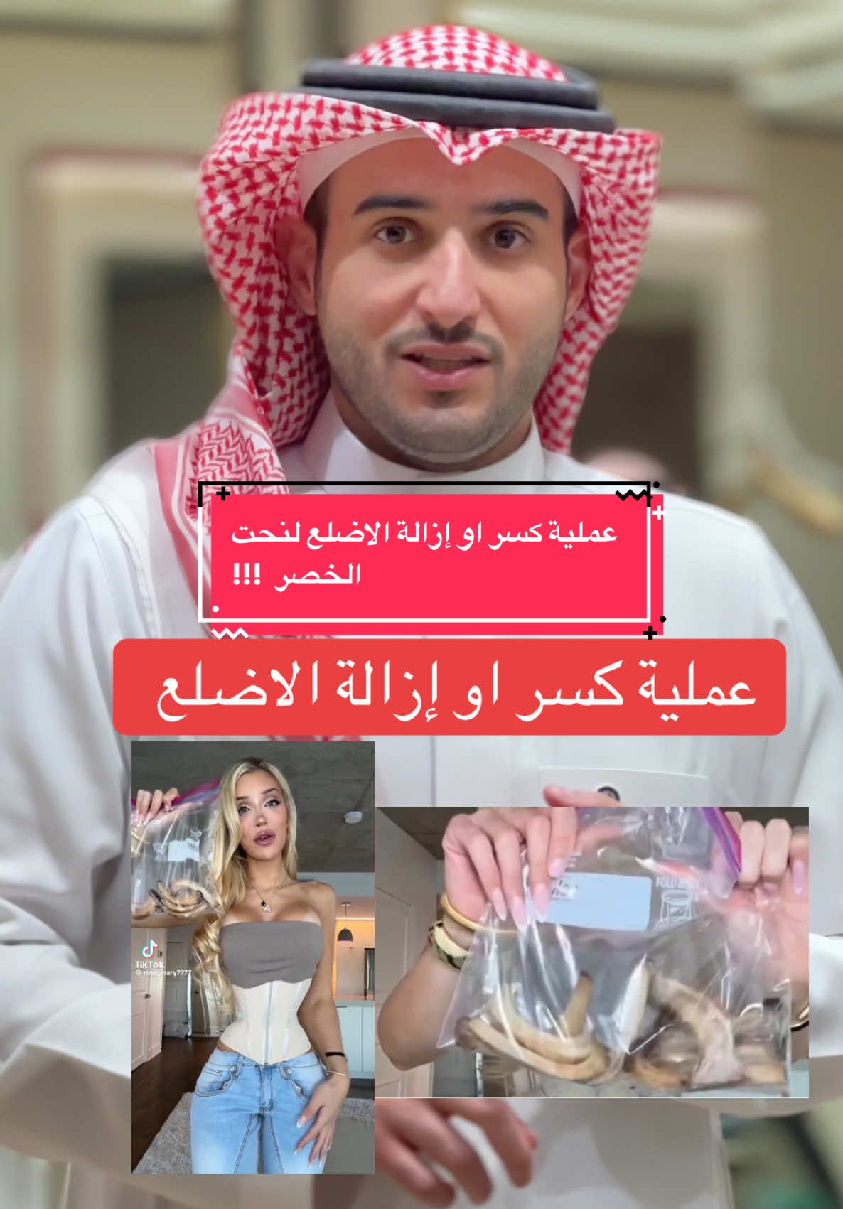 من الترندات الي طالعه اخر فتره عملية كسر او ازالة الاضلع 🤔 #foryou #explore #الرياض #عبدالمجيد_الهدلق #جراحة_التجميل 