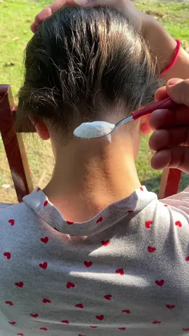 Put baking soda on the back of your neck and you won't believe the results! #Health #Skin #LifeTips