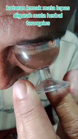 kotoran lemak mata keluar digurah mata herbal teruqplus #gurahmata #teruqplus #gurahmata #viralvideo #fyppppppppppppppppppppppp 