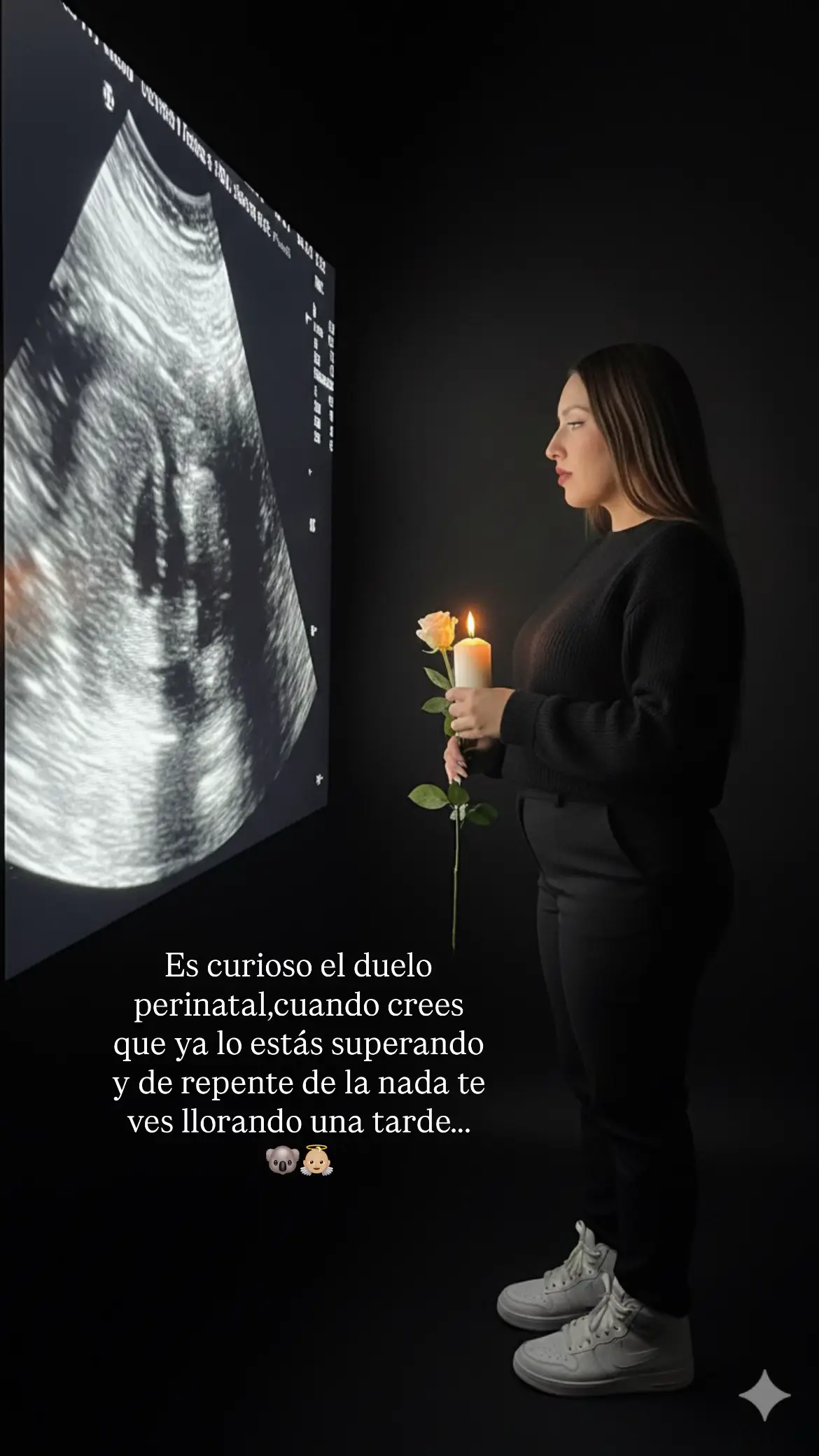 🐨👼🏼#bebecometa🥺💖☄️🌠 