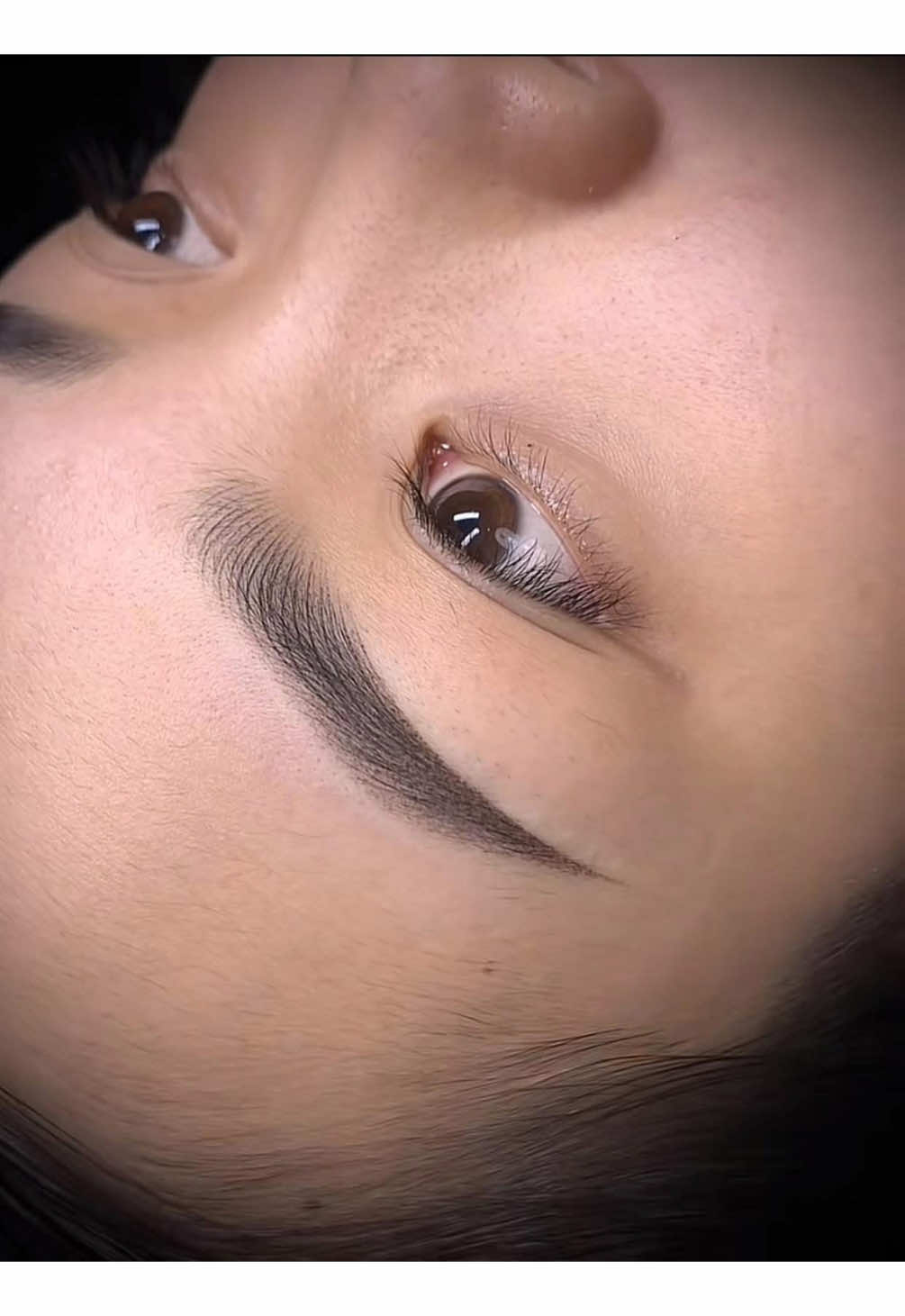 Xoá Lông Mày Bị Xanh cho chị khách Long an#thammyvananhquan6 #xoaxamlaser #xoaxamlaserpico #xoachanmay #xoamay 