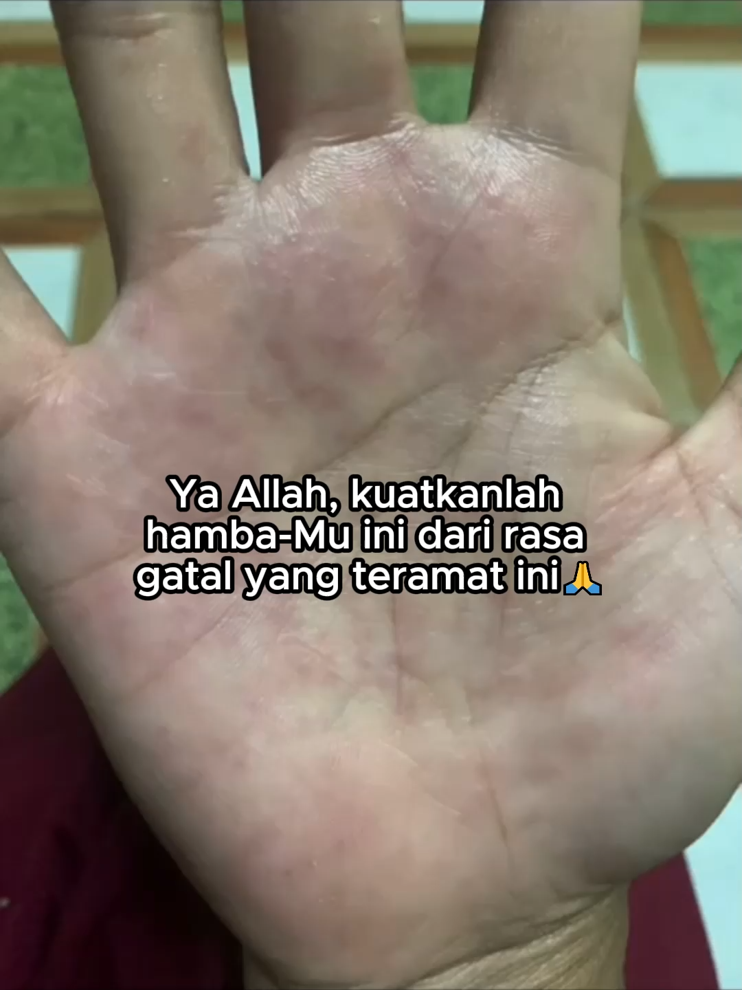 Pedih banget, kalo udh kambu, gatel iritas, untuk udh pake ini !! #blackseven7 #salepblack7 #salepblackseven #salepkulit #ampuh #gatalgatal