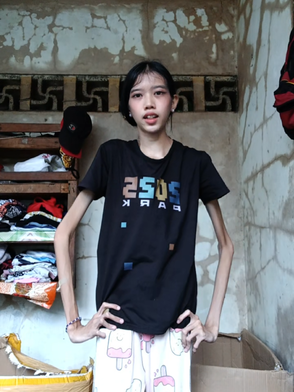 I really love to dance even though I have severe scoliosis; I just enjoy it. #fyp #viraltiktok #scoliosischeck 