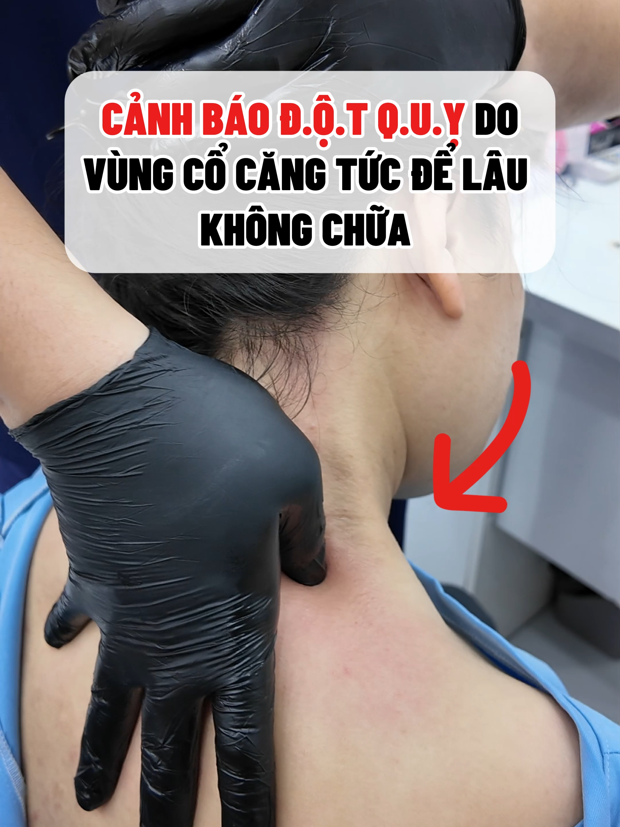 CẢNH BÁO ĐỘT QUỴ DO VÙNG CỔ CĂNG TÚC LÂU NGÀY#lernontiktok #xuhướng #suckhoe #viral #dotquy #tintam