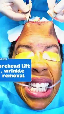 #viraltiktok #hairgrowth #oil 