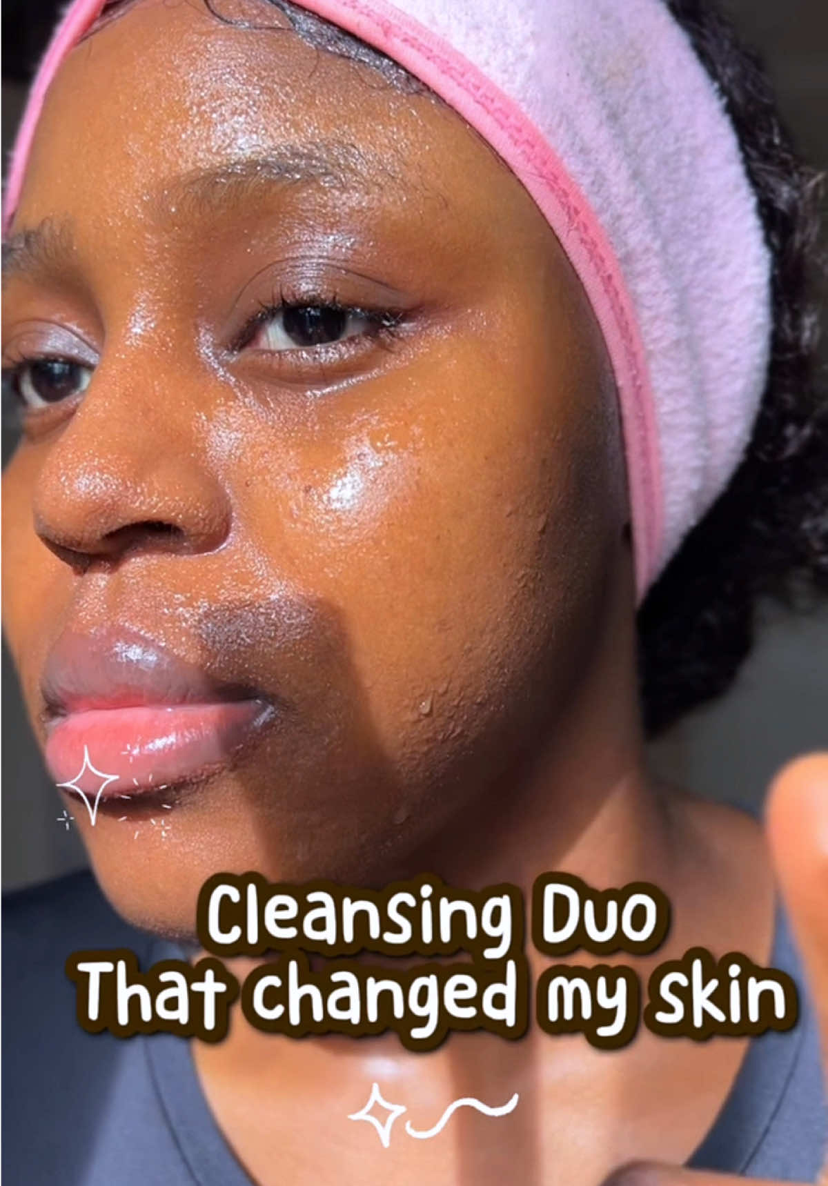 Putting you on this Effective Cleansing Duo because nobody deserves Acne!🫨 💦MIXSOON CLEANSING OIL daily cleansing oil that provides deep cleansing of the skin with moisturizing properties and is irritation-free. Suitable for all skin types, even good for oily skin. No alcohol. No artificial fragrance. Key Ingredients: Soybean Fermented Extract, Fermented Barley, Pomegranate, and Pear@mixsoon_global  💫ALL CLEAR BUBBLE CLEANSER Formulated with 2% Salicylic Acid to help clear out bacteria and exfoliate inside the pore. Helps prevent breakouts by clearing away dirt and oil Cleanses without stripping skin Includes barrier-supporting and hydrating ingredients like Niacinamide, Aquaxyl, and Green Tea Can be used daily without over-drying Suitable for all skin types: dry, oil, acne-prone and even sensitive #salicylicacid #acnefighter #acneproneskin #oilyskin #doublecleansing @Bubble Skincare 