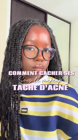 Cacher ses taches d’acné sous son makeup 🍒 |#makeup #acné #hyperpigmentation #makeuptutorials #fyp 