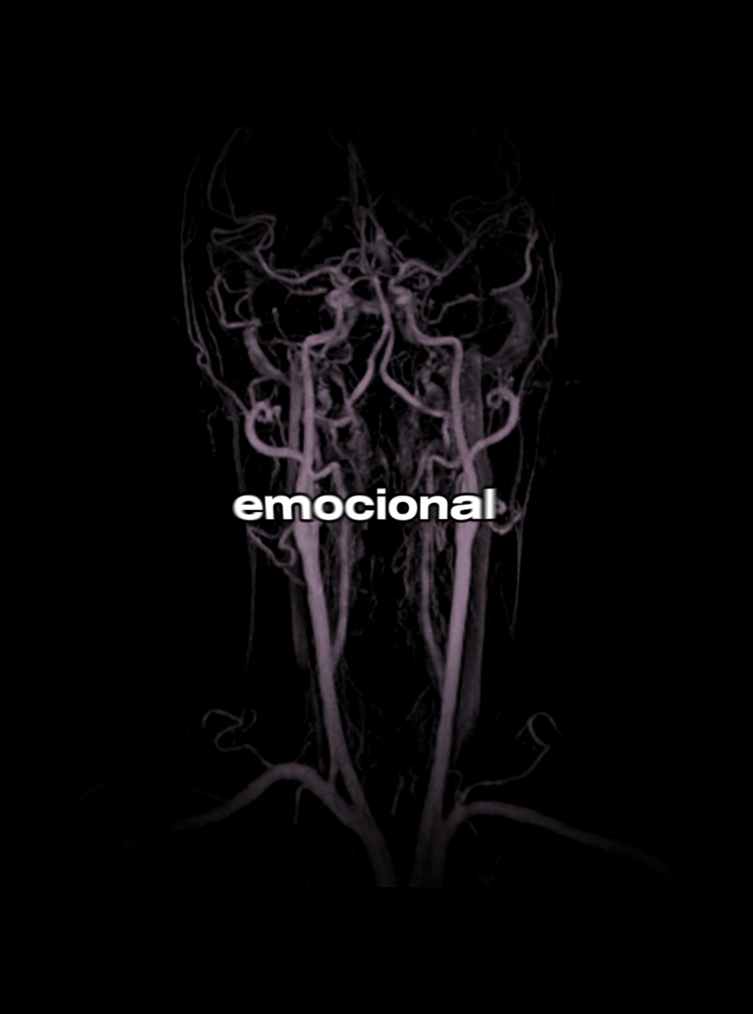 HIPERSENSIBILIDAD EMOCIONAL 🧠 #neurociencia #psicologia #cerebro #fyp 