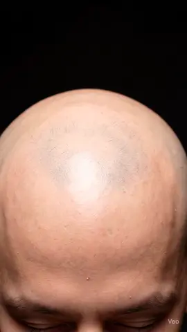 Tag someone who needs this #ASMR #hair #satisfyingvideo
