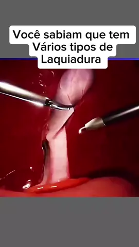 #CapCut Você sabiam que existe várias tipos de laquiadura #laquiadura #vidasaudavel #saude 