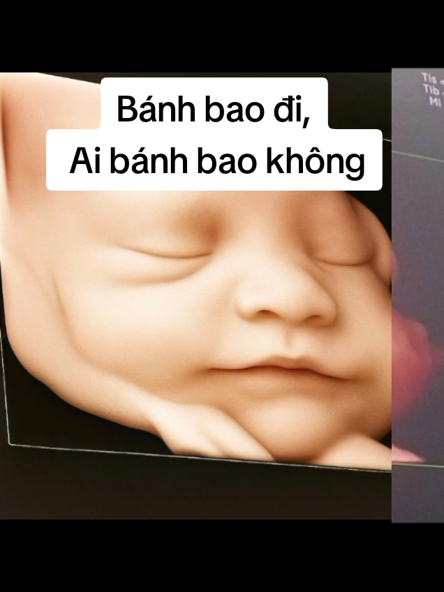 Trả lời @nhung001hg ai bánh bao hông #dunghinhembe #dunghinhsieuam #mebau #sieuam5d #thacsiphuoc 