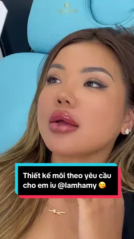 Cái gì khó đã có Orchard lo 😘  Nay có khách quý yêu cầu làm dáng môi hở răng lạnh 😂 Chị em chấm mấy điểm cho case môi siêu khó đỡ của @iamhamy ?  #orchardgroup #fillermoi #lamdepantoan #moisexy