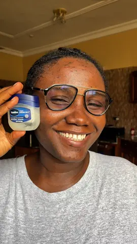 4 Vaseline hacks I wish I knew sooner ✨ #deadskinremover #beautyhacks #fyp  #vaseline #hacks  