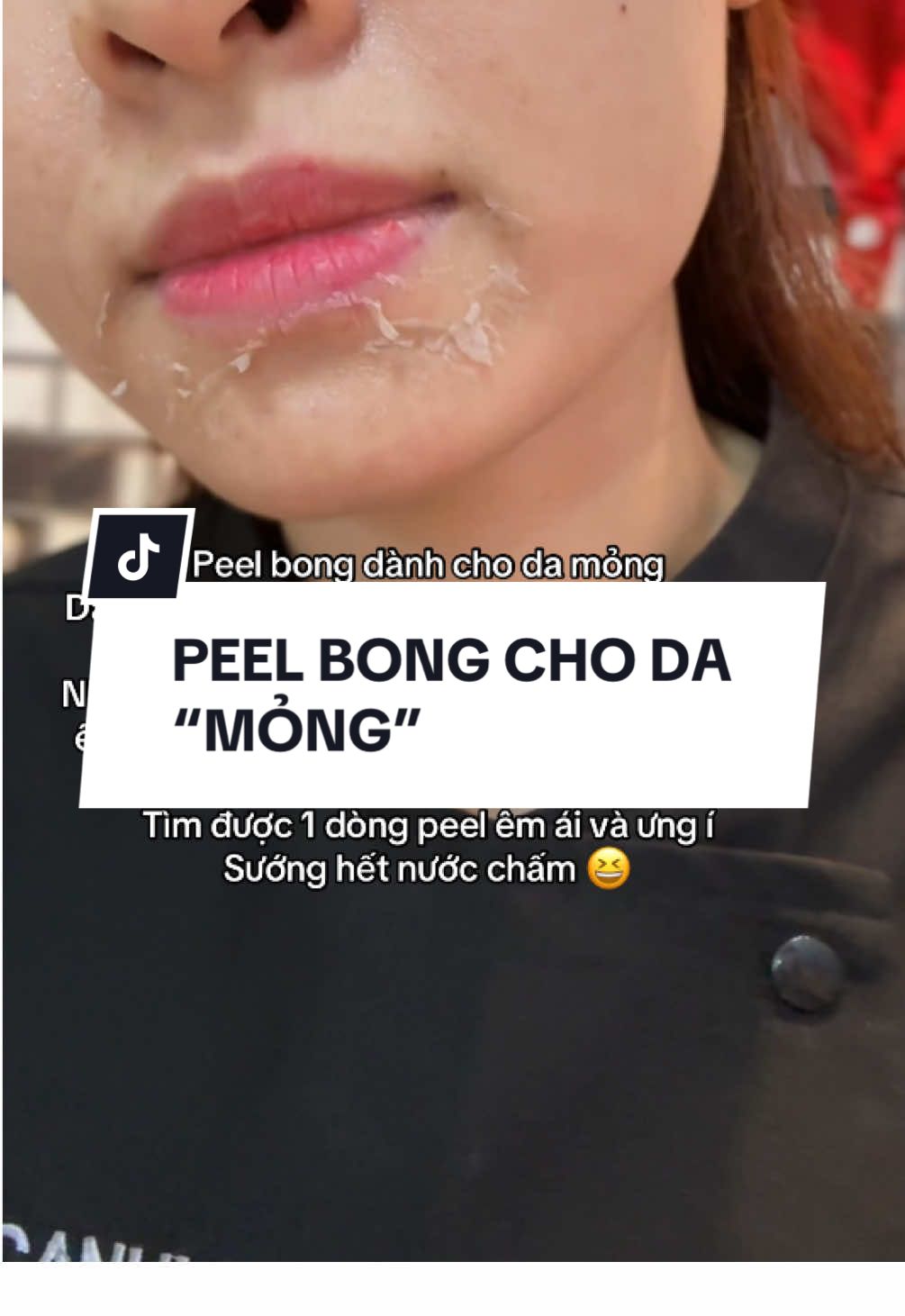 Peel bong dành cho da “mỏng” Da em Ánh siêu mỏng chưa bao giờ dám peel mạnh vì em Ánh sợ cảm giác nóng rát  Nhưng nay đã có 1 dòng peel ko nóng rát siêu êm và bong nhiều cho “da mỏng” như em Ánh rồi!  Tìm được 1 dòng peel êm ái và ưng í  Sướng hết nước chấm 😆 #peeldaquan7 #peelmun #hocpeel #Nanmunquan7 #peelmotham 
