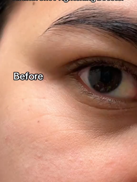 The Vita A Retinal Shot Tightening Booster | with Retinal, Matryxyl, Pore Minimizer, Wrinkles & Fine Lines, Firmer Skin, 15ml, Retinol Skincare#retinal #skincare #firmskin #tightening #kbeautytips