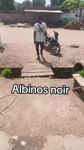 Albinos noir #burkinafaso #burkinatiktok🇧🇫🇧🇫🇧🇫❤️ #videoviral #ibrahimtraorepresident #burkinatiktok 