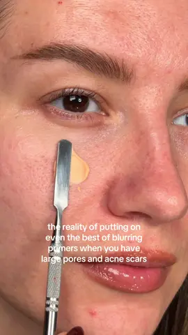 When your skin is textured - large pores, acne scars - even the best blurring primers won’t completely hide the texture. And it’s okay!!! Your skin is beautiful. Most of the people/ads/campaigns in the beauty industry use editing and filters. I am here to show you what real skin with real makeup looks like❤️ #realskin #skintexture #texturedskin #blurringprimer #makeup 