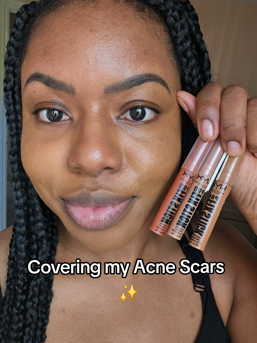 ✨️ How I cover my Acne scars using the NYX ProSticks 👌🏾 @nyxcosmetics_uk #acnescars #acneproneskinmakeup #nyxconcealer #acnecoverage #darkskinmakeup 