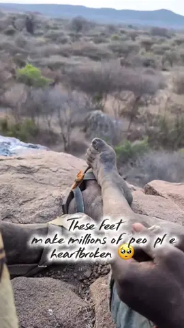 Chaaba's legs 🥺 #hadzabe #hadzabetribe #chaaba #dudukwe #chabamoments 
