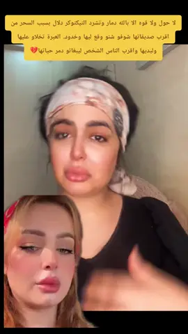 لا حول ولا قوه الا بالله العلي العظيم دمار وتشرد التيكتوكر دلال بسبب السحر من اقرب صديقاتها شوفو شنو وقع ليها وخدو العبرة تخلاو عليها وليديها واقرب الناس الشخص ليبغاتو دمر حياتها💔#اكسبلورexplore❥🕊 #الصين_ماله_حل😂 #explore #فرنسا🇨🇵_بلجيكا🇧🇪_المانيا🇩🇪_اسبانيا🇪🇸 #التيكتوكر_دلال 