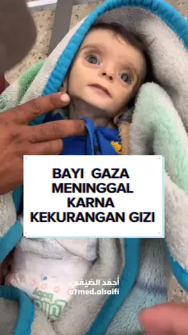 Seorang anak meninggal karena kekurangan gizi Yuk Kita Terus Bantu Palestina   klik link : https://bit.ly/BerbagiInfaqPalestina Transfer Rekening Bantu Palestina  🏧BSI 701 551 824 8 🏧Muamalat 101 00822 08 Konfirmasi Transfer Bantu Palestina Serta Konsultasi Infak Rumah Zakat Batam: Nita  081265298544 Ganjar 085862604177 #RumahZakat #BikinBahagia #Kemanusiaan #Palestina #GencatanSenjata 