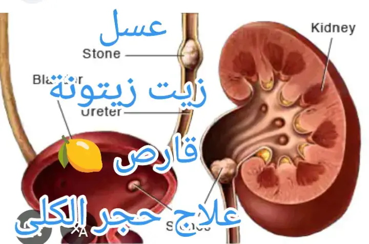 #الكلى_المشاكل_والضمور_والضعف #علاج_طبيعي #اعشاب_طبيعية #توانسة_دزيرية_مغاربة_ليبية 