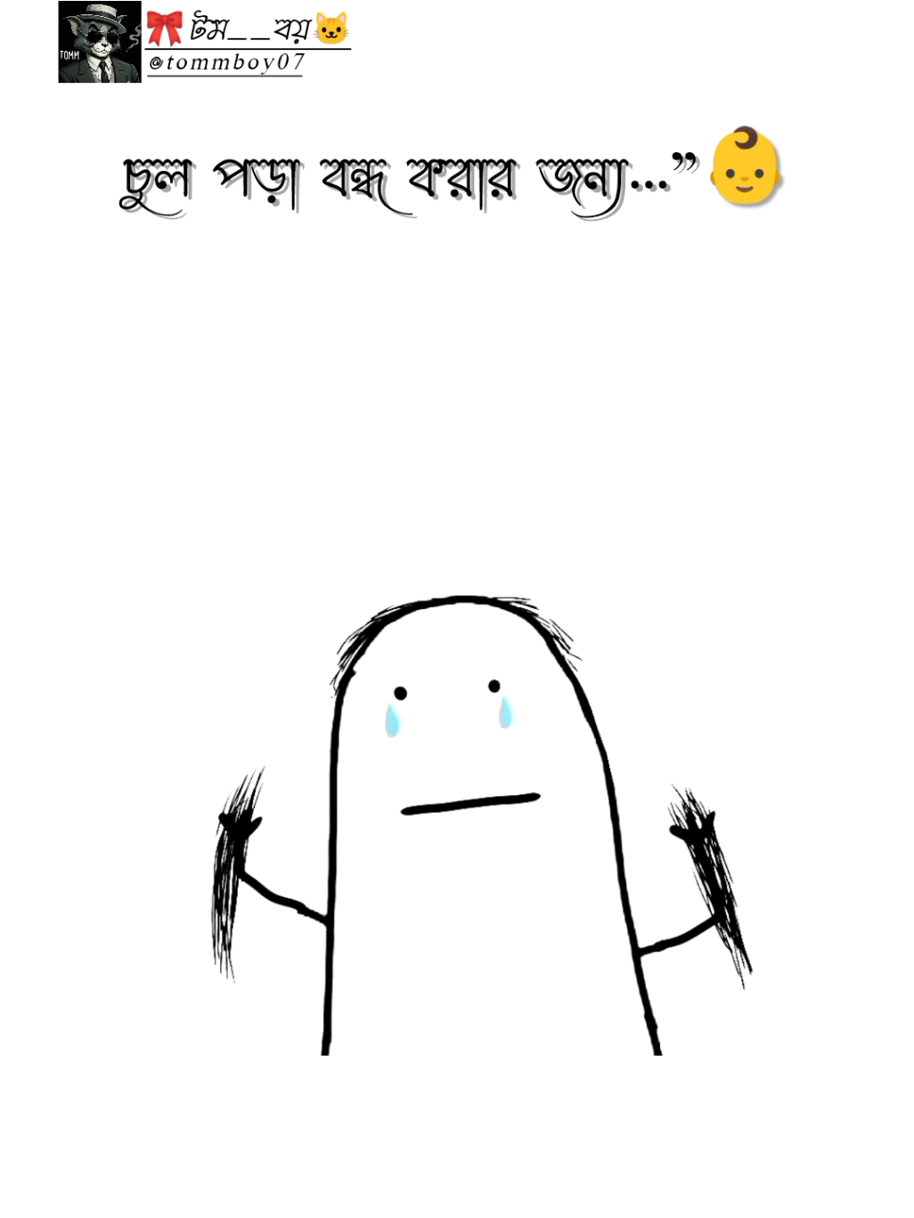 #চুল পড়া বন্ধ করার জন্য..!!🙂 । । । । #Foryou #unfrezzmyaccount #Vairal #ফরইউতে_দেখতে_চাই @TikTok 
