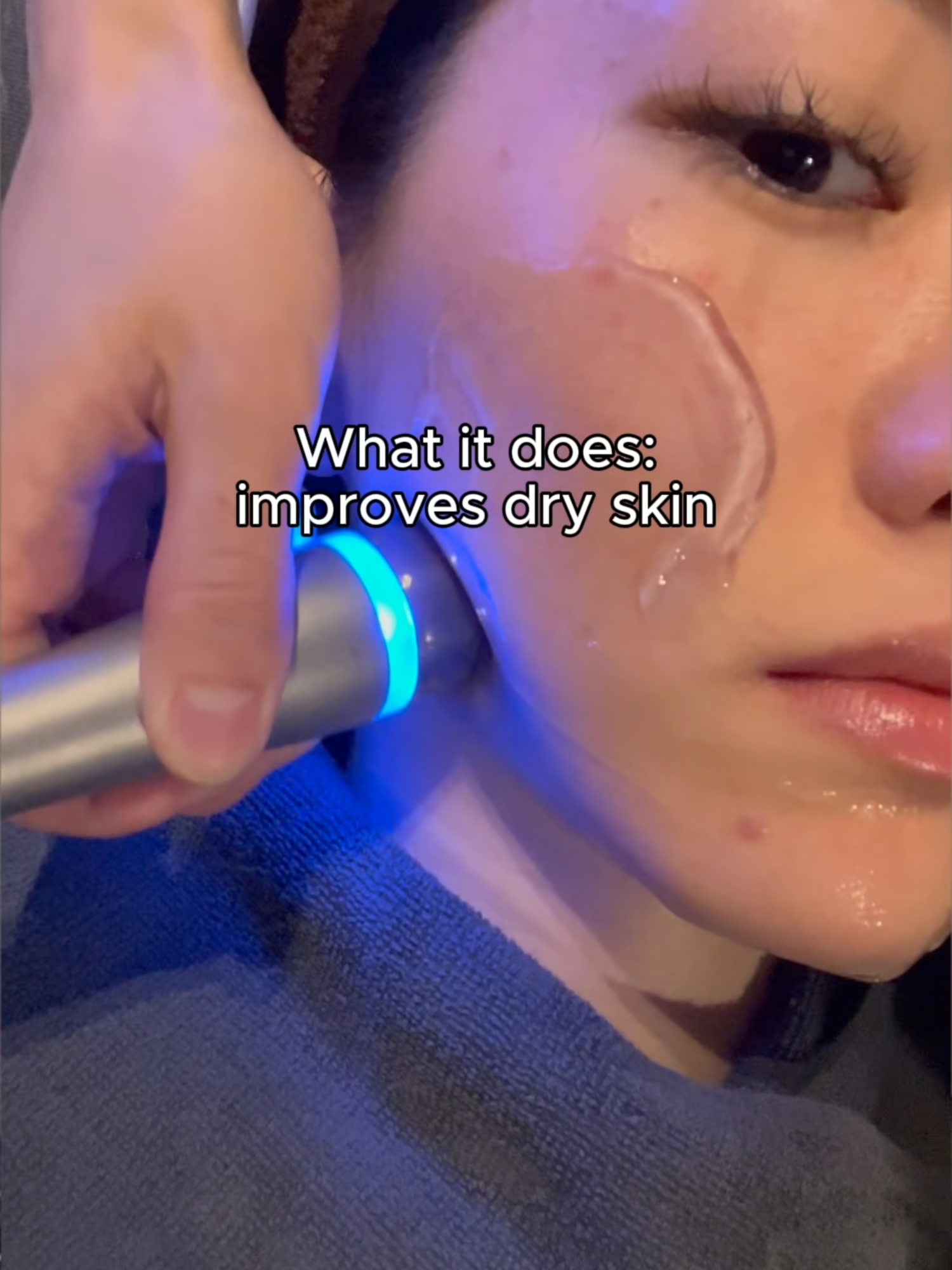 Prepping my skin for Autumn with LDM! Visit Forena Clinic for LDM treatment. What it does: ✔️ Improves dry skin ✔️ Calms acne & redness ✔️ Enhances elasticity with collagen ✔️ Refines skin tone & texture Can't wait? Take a look in K-Beauty Station! #glowingskin #makeuplover #koreantreatments #kbeautyclinic #seoulskincare #koreanbeauty
