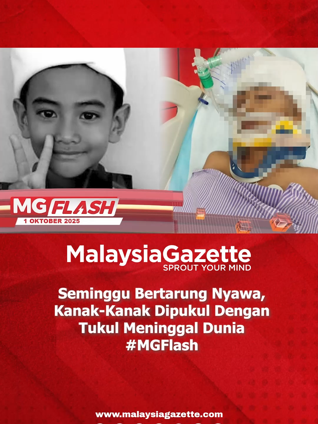 Selepas seminggu bertarung nyawa, kanak-kanak lelaki yang cedera parah akibat dipukul dengan tukul oleh bapa saudaranya di sebuah rumah kedai di Pasar Jelawat, Bachok, Kelantan, disahkan meninggal dunia petang tadi.