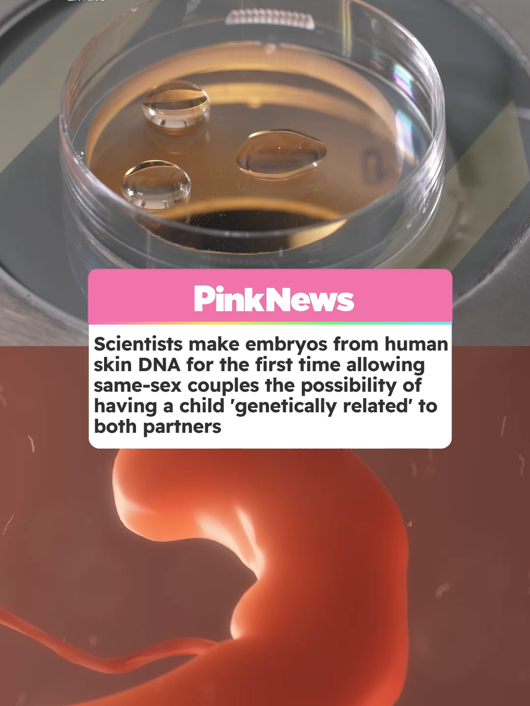 US scientists have made early-stage human embryos by manipulating DNA taken from human skin cells. The Orgeon Health and Science University research team uses the nucleus, which houses a copy of the entire genetic code, out of a skin cell and then places it inside a donor egg.However the egg isn't ready to be fertilised as it already contains a full suite of chromosomes.  Scientists are hoping they can persuade the egg to discard half of its chromosomes in the next step.Proffesor Paula Amato, from Oregon Health and Science University, said: 
