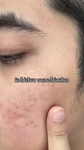 ให้เวลาหน่อยดิ #เจลล้างหน้า #เจลเขียวลดสิว #คลีนเซอร์เขียว3x #skintificcleanser 