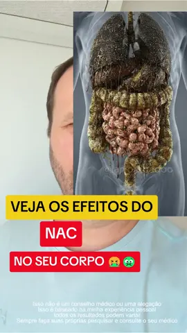 #nac 