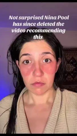 Using Tucks pads under your eyes? 👀 They’re made for hemorrhoids, not hollows. 🙃 Witch hazel might tighten for a minute, but it can also dry and irritate that delicate skin. Your under eyes deserve hydration + support, not bathroom hacks. 𝐁𝐞 𝐬𝐮𝐫𝐞 𝐭𝐨 𝐟𝐨𝐥𝐥𝐨𝐰 👉 @𝐩𝐮𝐫𝐞𝐬𝐤𝐢𝐧𝐨𝐜! #skintips #skincaretips #koreanskincare #estheticiantips #skincareproducts                          