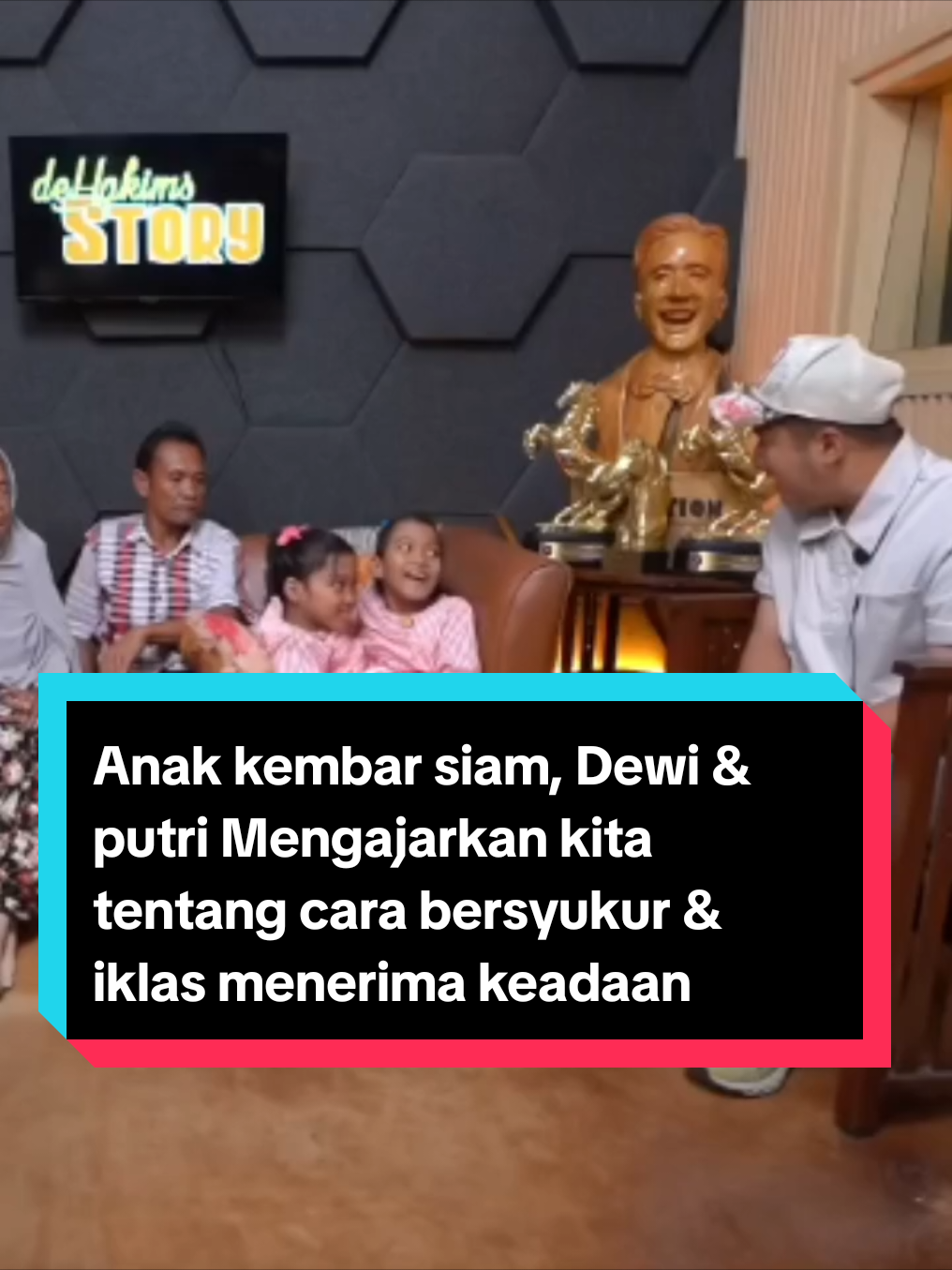 Anak kembar siam, Dewi & putri Mengajarkan kita tentang cara bersyukur & iklas menerima keadaan dengan lapang dada  #thehakims 