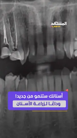 وداعًا لزراعة الأسنان.. عقار ياباني جديد يحفّز الخلايا الجذعية لتكوين أسنان طبيعية، فما الذي نعرفه عنه؟ #طب #أسنان #المشهد_لايت #اخبار_المشهد