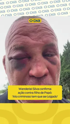 Lutador diz que está impedido de fazer trabalhos 🥊 Com o rosto ainda bastante marcado, Wanderlei Silva publicou mais um vídeo para detalhar as sequelas que vem enfrentando desde o soco que o fez desmaiar durante a briga generalizada no Spaten Fight Night 2, no último sábado, em São Paulo. A lenda do MMA ainda garantiu que buscará a responsabilização e processará o seu agressor, Rafael Freitas, filho de Popó. O lutador se mostrou abalado pelas imagens em que aparece caído e sendo retirado por pessoas que nem faziam parte da segurança do evento. Além disso, reclamou do prejuízo financeiro por ter que ficar em casa em recuperação das muitas lesões no rosto. 📸 Reprodução Redes Sociais Acesse nosso site: odia.com.br #Luta #WanderleiSilva #Popó #Justiça #ODia