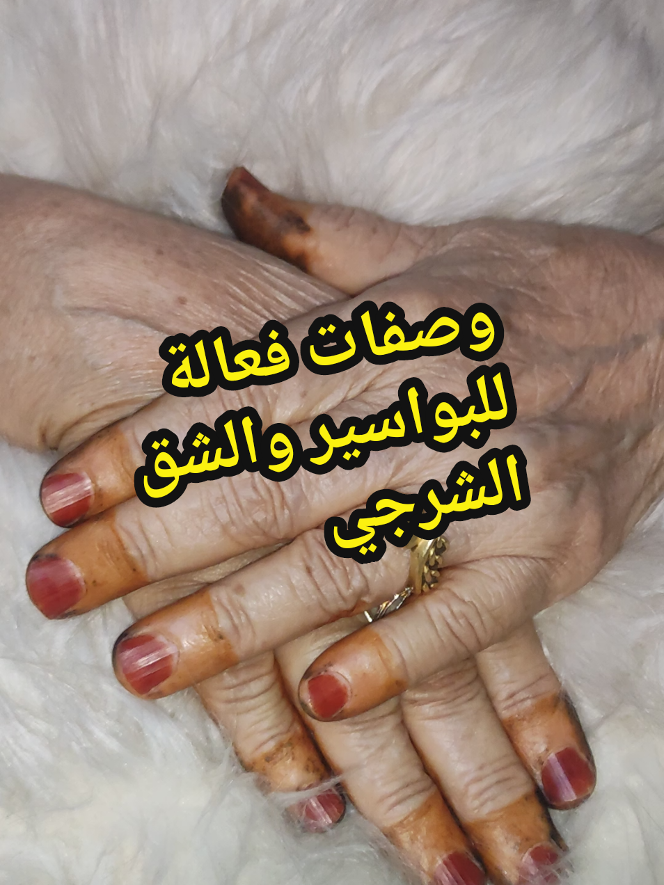 الرد على @ishak_633  وصفات ناس زمان لعلاج البواسير والشق الشرجي.  #ناس_زمان  #وصفات_ناس_زمان  #ناس_زمان_قالوا  #tiktokalgeria  #explore 