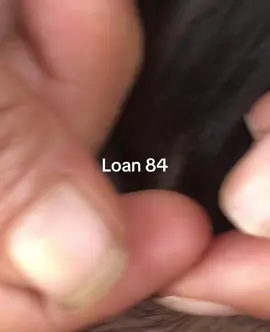 lice removal #omg😱😱 #lice #😱😱😱 #trending #
