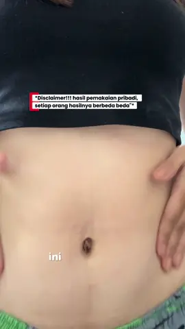 Bye strechmark!! thanks ciara  #stretchmarks #stretchmark #stretchmarkserum #stretchmarkoil #ciaraindonesia 
